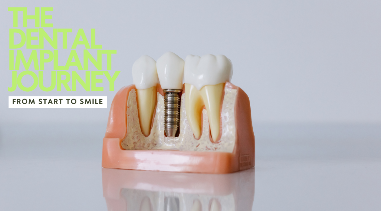 blog inner thumb : Hello dental