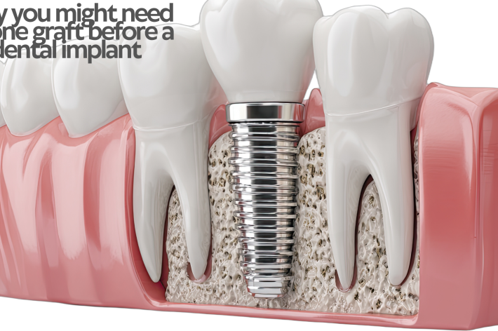blog - Hello Dental